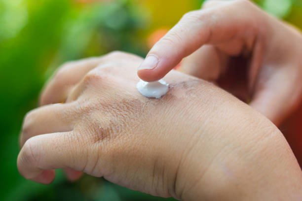 قیمت خرید کرم عفونت پوست با فروش عمده